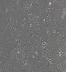 HULEC-5a人肺微血管內(nèi)皮細胞主圖