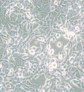 95-D[PLA-801D]人高转移肺癌细胞主图