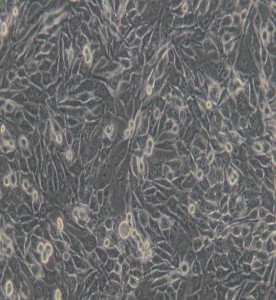 MDA-MB-435S人乳腺癌细胞/人黑素瘤细胞(M14污染细胞系)主图